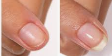 Nails