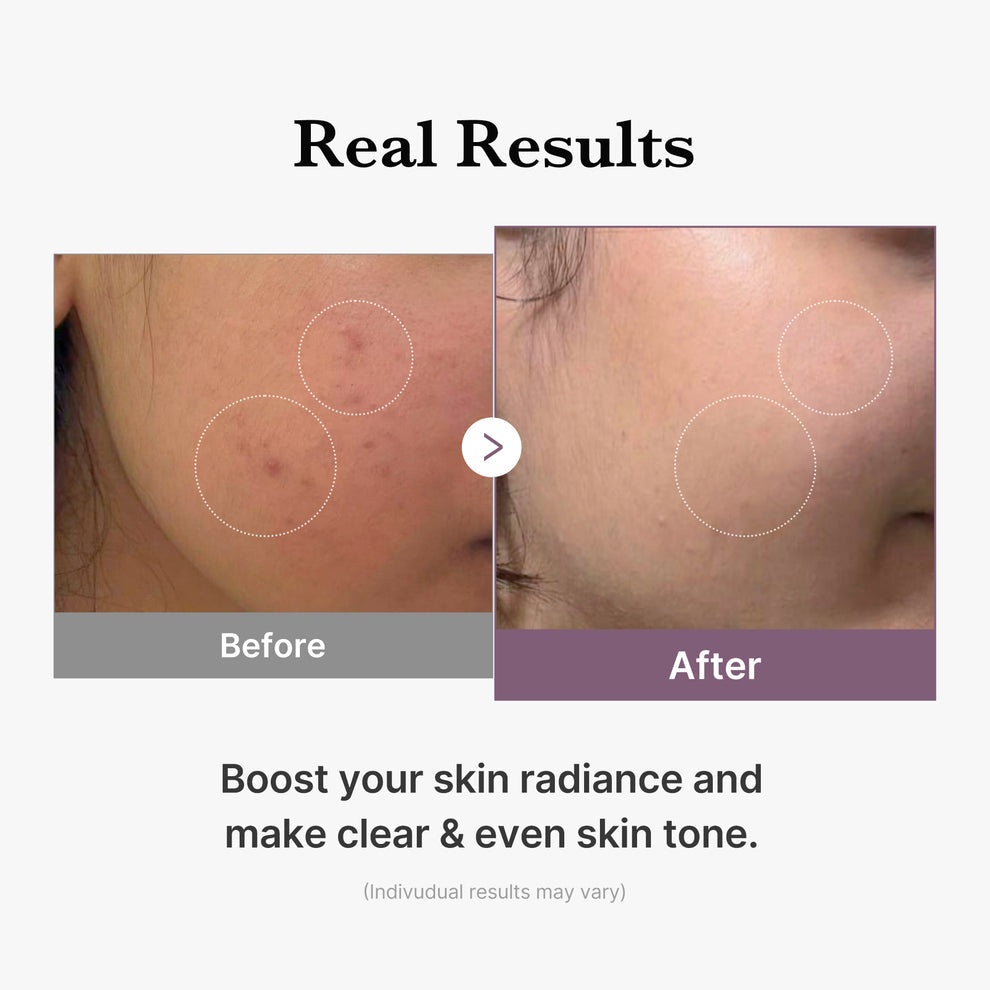 Medicube AGE-R GLUTATHION GLOW Toner [140 ml]
